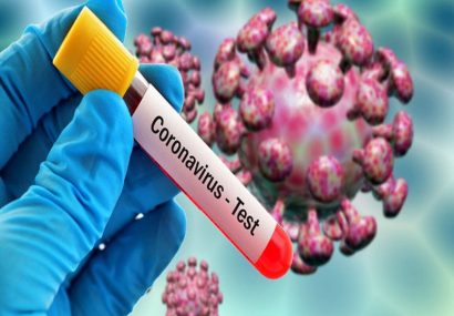 ۴۸ نفر در آذربایجان‌شرقی به ویروس کرونا مبتلا هستند